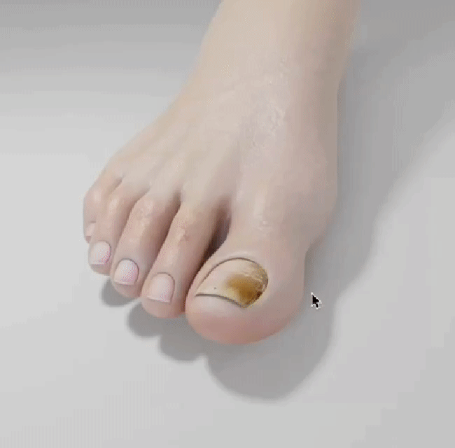 Anwendung des Caelura Nagelpflege-Stifts